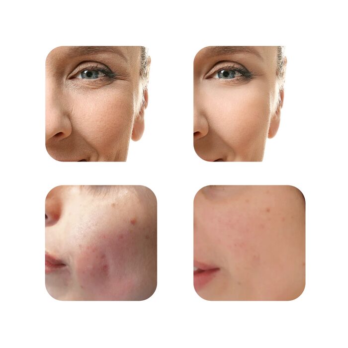 Serum za lice Retinol 2.5%