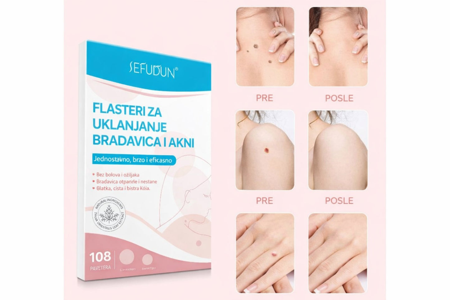 Flasteri Za Bubuljice