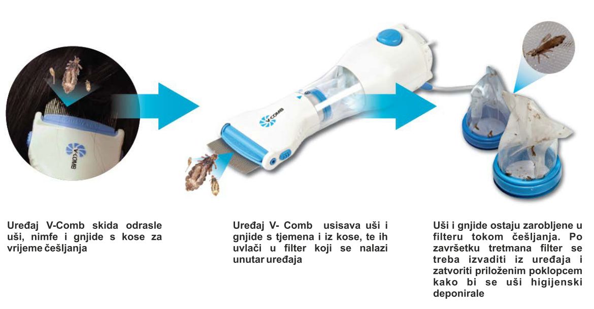 Električni Češalj Protiv Vaši