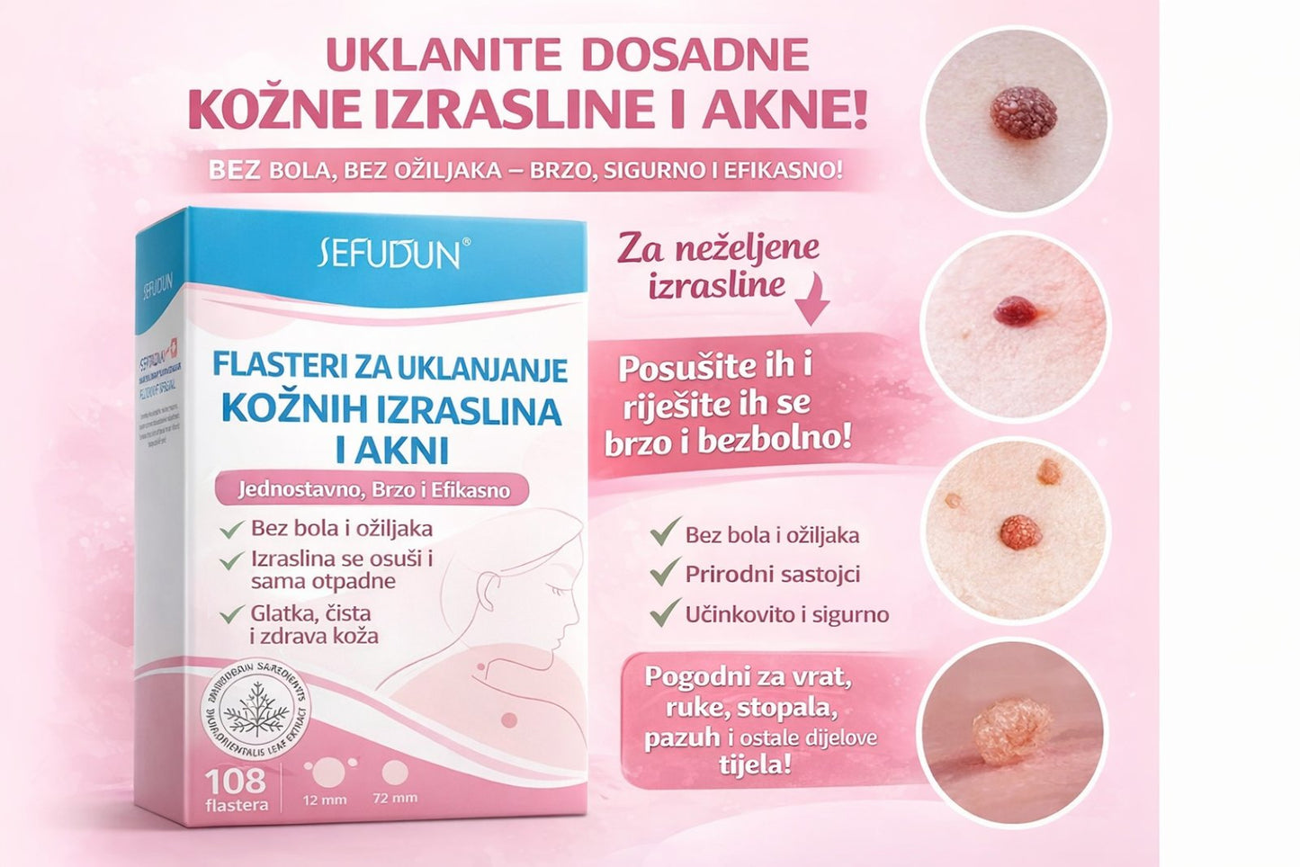 Flasteri Za Bubuljice